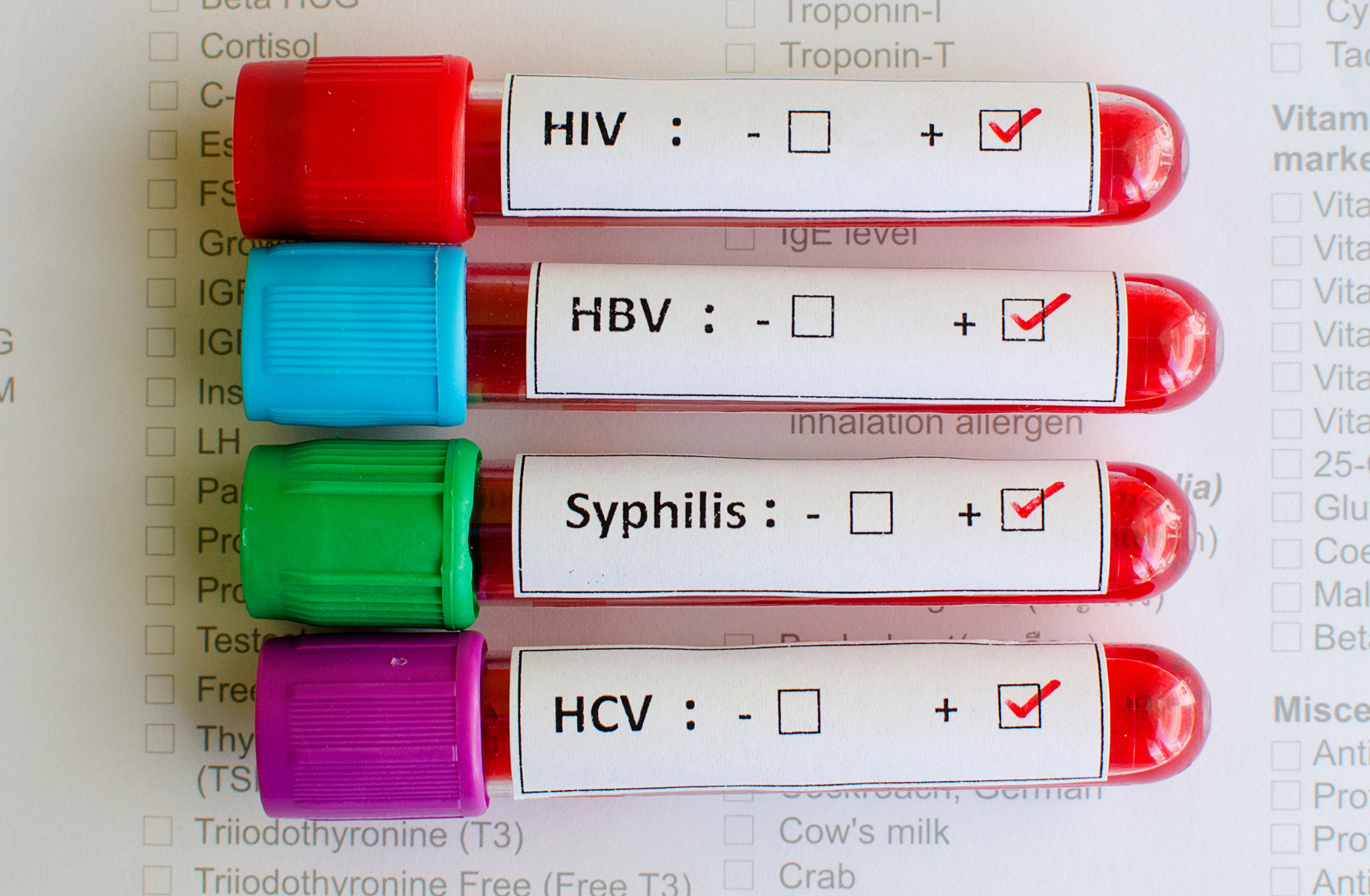 Sexually Transmitted Infections or STIs